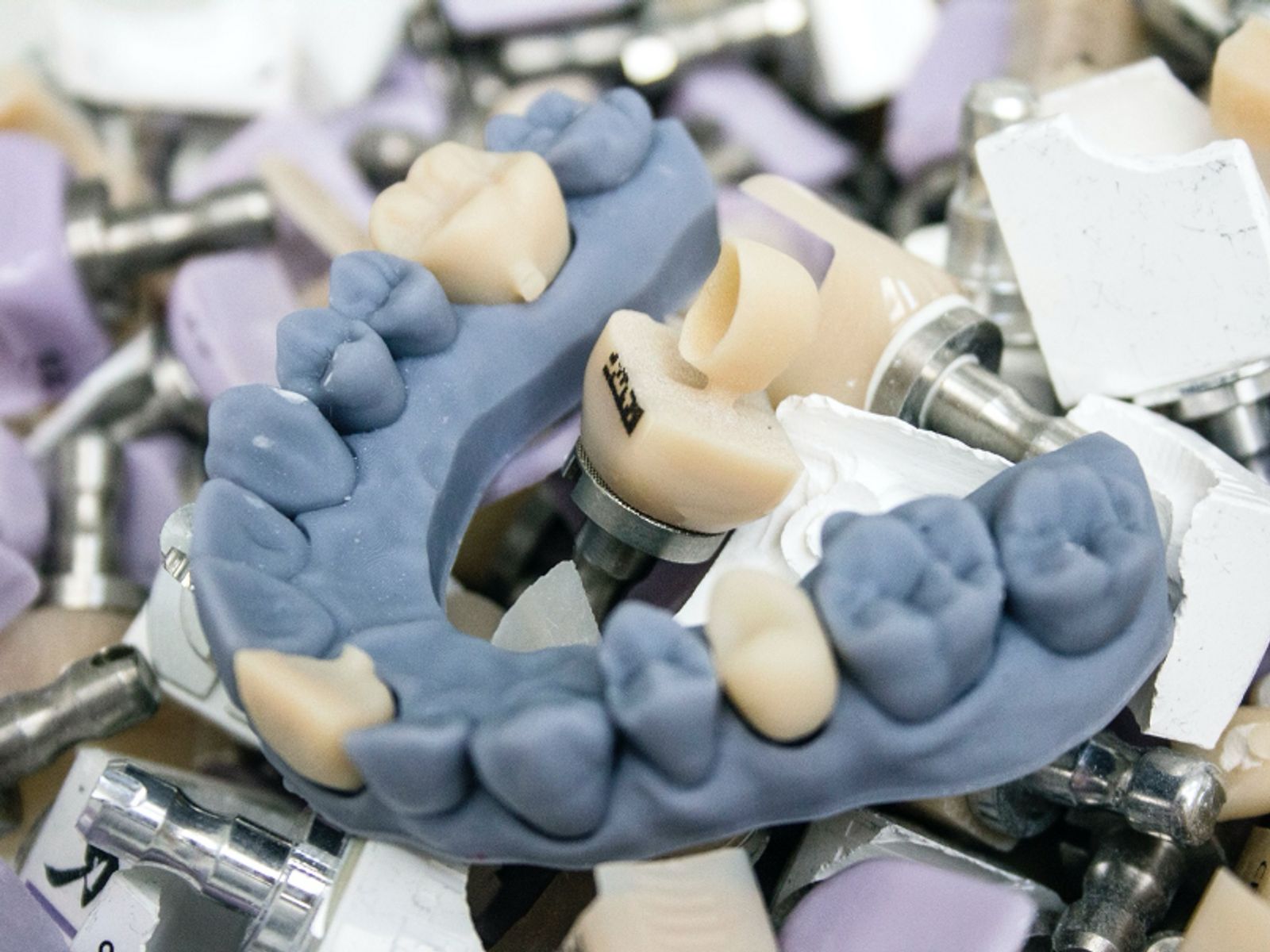 CEREC Keramikblöcke für individuellen Zahnersatz