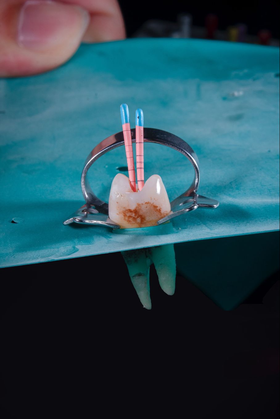Modernes Behandlungszimmer für Endodontie